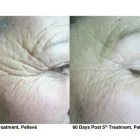 Business 4 image 1ST ASTRAL AERIALS LTD Aerial Services & Supplies in Nottingham No