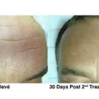 Business 7 image 1ST ASTRAL AERIALS LTD Aerial Services & Supplies in Nottingham No