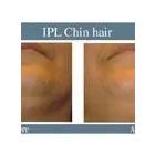 Business 18 image ABOUT FACE BEAUTY CLINIC Beauty Salons & Consultants in Glasgow La