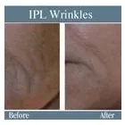 Business 3 image ABOUT FACE BEAUTY CLINIC Beauty Salons & Consultants in Glasgow La
