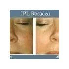 Business 8 image ABOUT FACE BEAUTY CLINIC Beauty Salons & Consultants in Glasgow La
