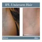 Business 1 image ABOUT FACE BEAUTY CLINIC Beauty Salons & Consultants in Glasgow La