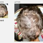 Business 15 image ADVANCED HAIR STUDIO Hair Consultants in Reading Be