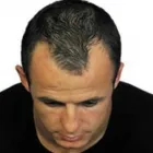 Business 1 image ADVANCED HAIR STUDIO Hair Consultants in Reading Be