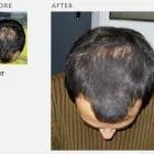 Business 3 image ADVANCED HAIR STUDIO Hair Consultants in Reading Be