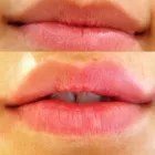 Business 1 image AESTHETIC NURSING SERVICES Spa Services in High Wycombe Bu