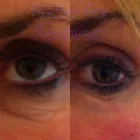 Business 2 image AESTHETIC NURSING SERVICES Spa Services in High Wycombe Bu