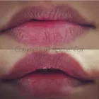 Business 4 image AESTHETIC NURSING SERVICES Spa Services in High Wycombe Bu