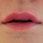 Business 6 image AESTHETIC NURSING SERVICES Spa Services in High Wycombe Bu