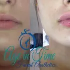 Business 2 image AGE IN TIME Plastic & Cosmetic Surgery in Bristol Br