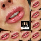 Business 10 image ANGELA FOX PMU & AESTHETICS Plastic & Cosmetic Surgery in Altrincham Ch
