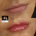 Business 17 image ANGELA FOX PMU & AESTHETICS Plastic & Cosmetic Surgery in Altrincham Ch