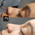 Business 26 image ANGELA FOX PMU & AESTHETICS Plastic & Cosmetic Surgery in Altrincham Ch