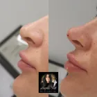 Business 43 image ANGELA FOX PMU & AESTHETICS Plastic & Cosmetic Surgery in Altrincham Ch