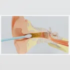 Business 37 image CHESHIRE EAR WAX REMOVAL & MICROSUCTION SERVICES Medical Facilities in Cheadle Ch
