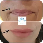 Business 2 image DR YASH AESTHETICS Tattoo Removal Service in Colchester Es