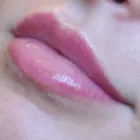 Business 3 image ESSJAY Skin Care Clinics in Doncaster So