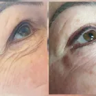 Business 6 image ESSJAY Skin Care Clinics in Doncaster So