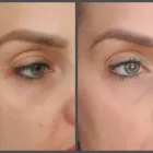 Business 7 image ESSJAY Skin Care Clinics in Doncaster So