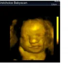 Business 1 image FIRST CHOICE BABY SCAN Private Clinics in Warrington Ch