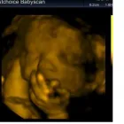 Business 2 image FIRST CHOICE BABY SCAN Private Clinics in Warrington Ch