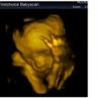 Business 3 image FIRST CHOICE BABY SCAN Private Clinics in Warrington Ch
