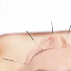 Business 6 image GRAHAME GARGINI MBACC MRCHM Acupuncture in Burton-On-Trent St