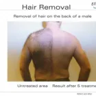 Business 8 image MAYERS LASER HEALTH & BEAUTY Skin Care Clinics in LEAMINGTON SPA Wa