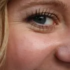 Business 2 image MEDSKIN CLINIC NOTTINGHAM Skin Care Clinics in Nottingham No