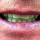 Business 5 image OATLANDS DENTAL LOUNGE Dentists in Weybridge Su