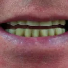 Business 2 image OATLANDS DENTAL LOUNGE Dentists in Weybridge Su