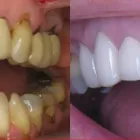 Business 8 image PARK PRACTICE Teeth Whitening in Glasgow La