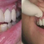Business 5 image PARK PRACTICE Teeth Whitening in Glasgow La