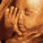 Business 4 image PROFESSIONAL ANTENATAL SERVICES LTD Pregnancy & Childbirth in Hinckley Le