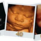 Business 3 image PROFESSIONAL ANTENATAL SERVICES LTD Pregnancy & Childbirth in Hinckley Le