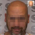 Business 4 image SCALP PERFECT Medical Facilities in Maidenhead Be
