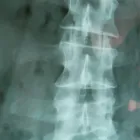Business 5 image SKELIAN CHIROPRACTIC CLINIC Chiropractors in Cheltenham Gl