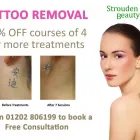 Business 4 image STROUDEN PARK BEAUTY CLINIC Tattoo Artists in Bournemouth Do