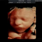 Business 2 image WINDOW TO THE WOMB WATFORD Personal Services in Watford He