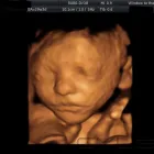 Business 3 image WINDOW TO THE WOMB WATFORD Personal Services in Watford He