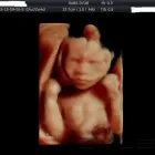 Business 4 image WINDOW TO THE WOMB WATFORD Personal Services in Watford He