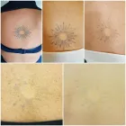 Business 17 image WITHOUT A TRACE LASER CLINIC Tattoo Removal Service in Tamworth St