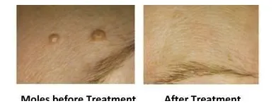 Business 22 image ABOUT FACE BEAUTY CLINIC Beauty Salons & Consultants in Glasgow La