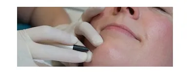 Business 2 image ABOUT FACE BEAUTY CLINIC Beauty Salons & Consultants in Glasgow La