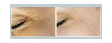 Business 5 image ABOUT FACE BEAUTY CLINIC Beauty Salons & Consultants in Glasgow La