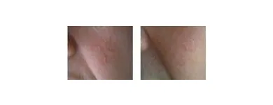 Business 6 image ABOUT FACE BEAUTY CLINIC Beauty Salons & Consultants in Glasgow La