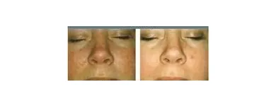 Business 8 image ABOUT FACE BEAUTY CLINIC Beauty Salons & Consultants in Glasgow La