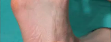 Business 4 image ACORN TAXIS Taxis & Private Hire Vehicles in Liverpool Me