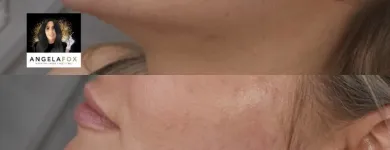 Business 1 image ANGELA FOX PMU & AESTHETICS Plastic & Cosmetic Surgery in Altrincham Ch