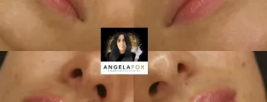 Business 2 image ANGELA FOX PMU & AESTHETICS Plastic & Cosmetic Surgery in Altrincham Ch